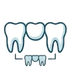 Dental Bridges