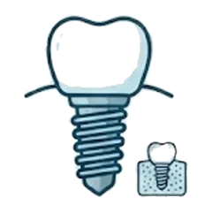 Implants